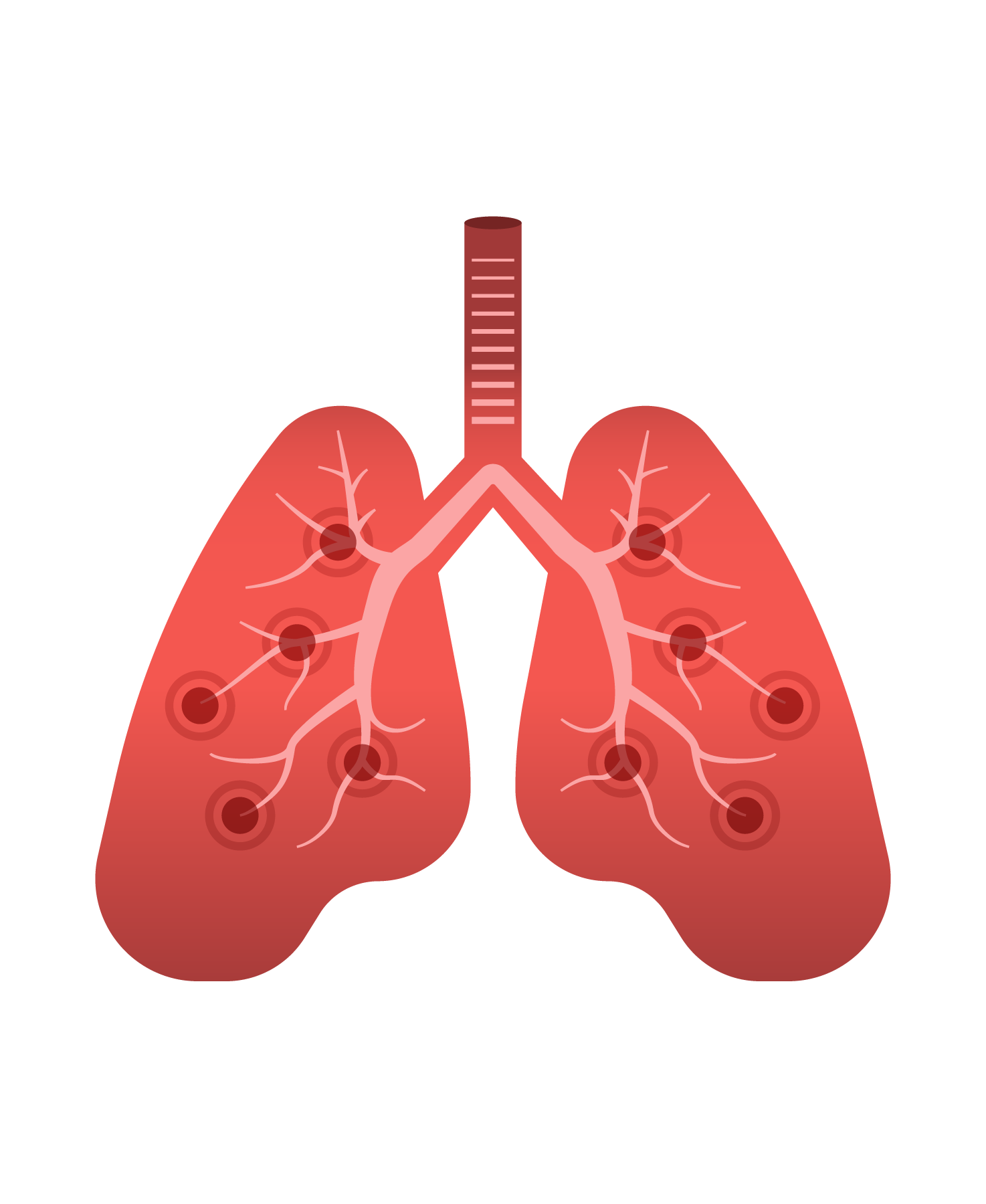 Simplified illustration of the lungs, BEconneCTD-ILD Study, interstitial lung disease, connective tissue disease